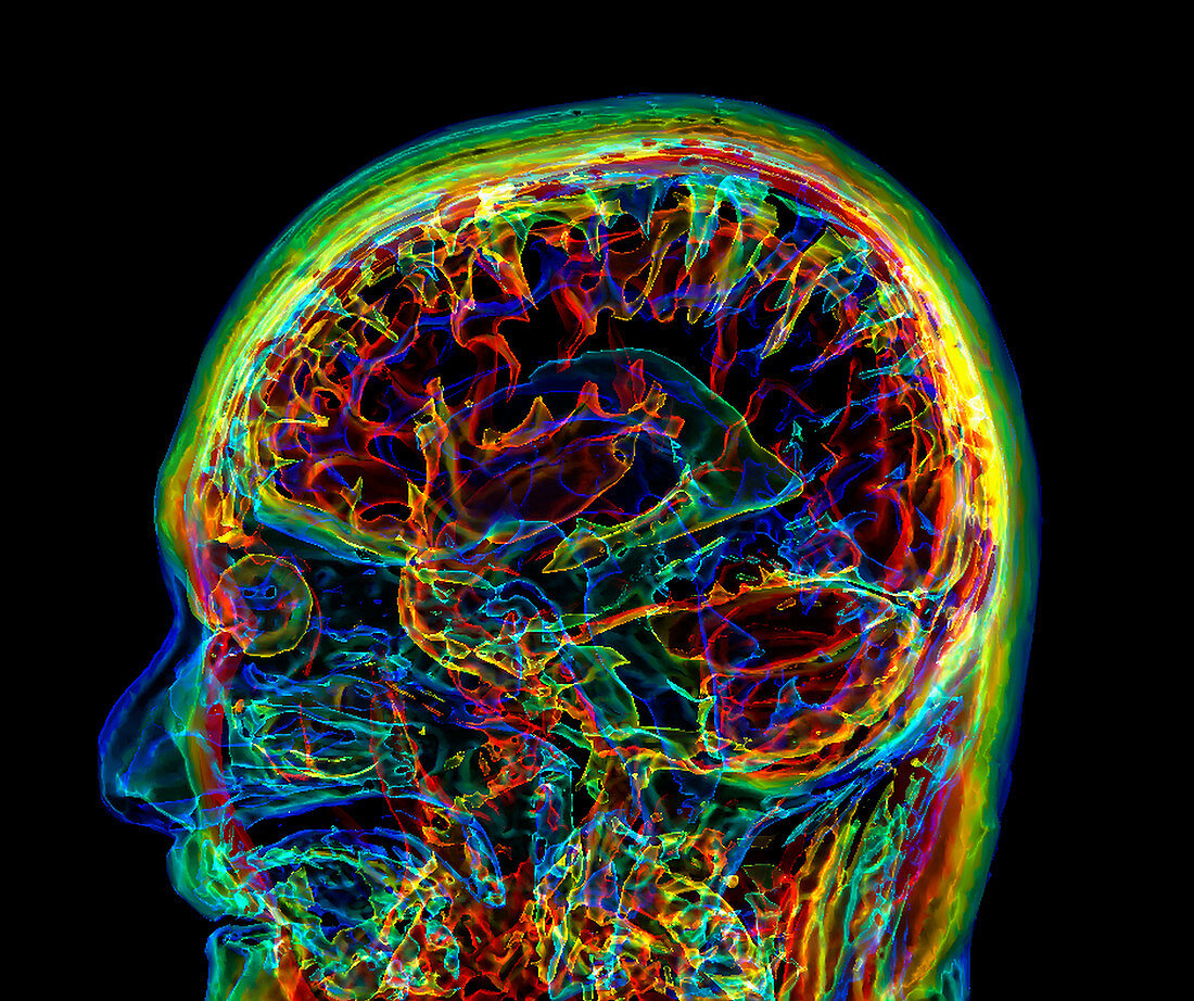 Human head and brain, 3D MRI scan