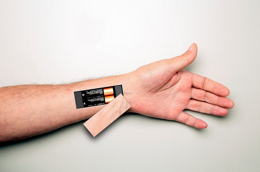 Battery-powered arm, conceptual image