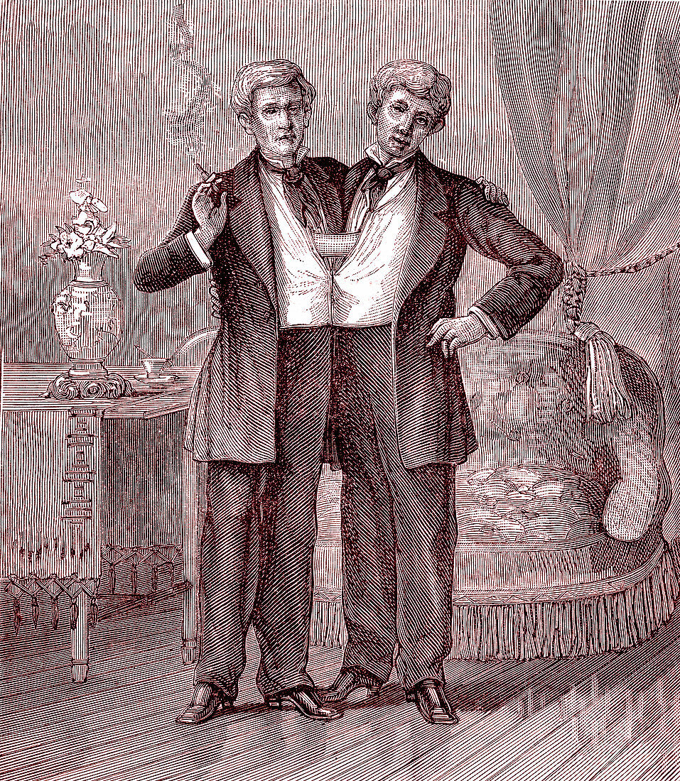 Chang and Eng conjoined twins, 19th century