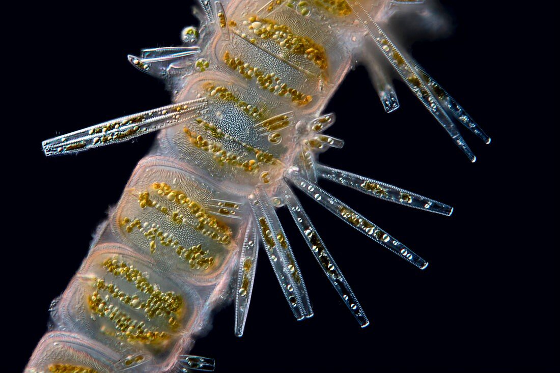 various Diatoms, light micrograph