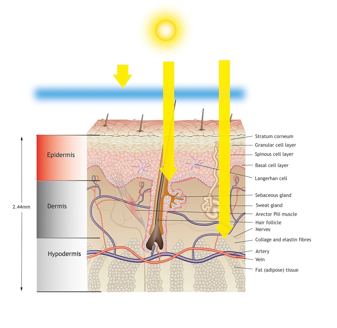 Sun damage to skin, illustration