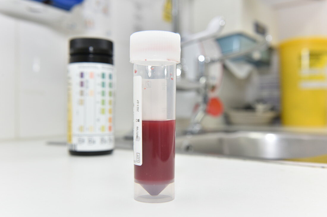 Testing for blood in a urine sample