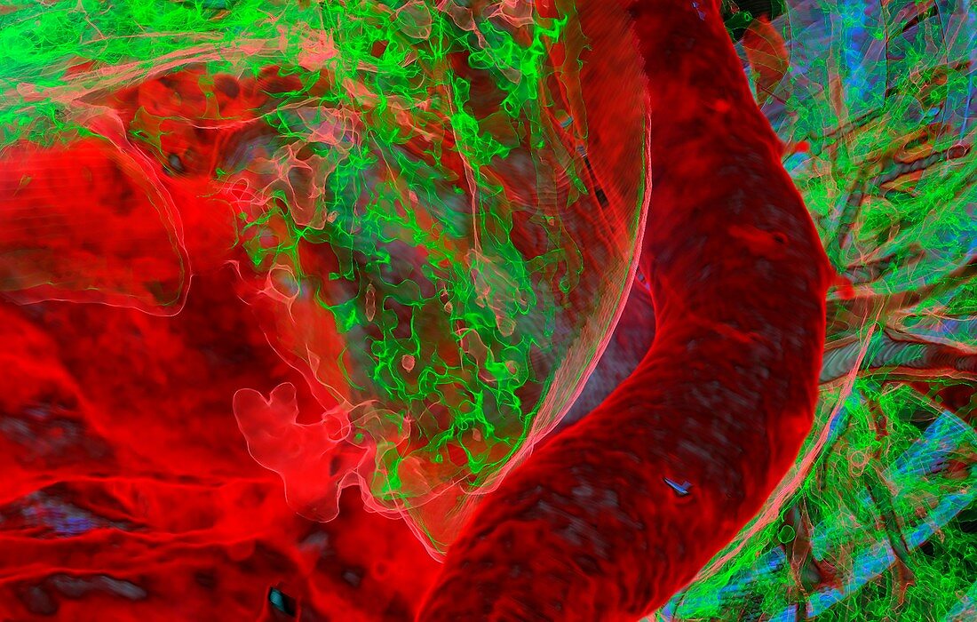 Heart and aorta, 3D CT scan