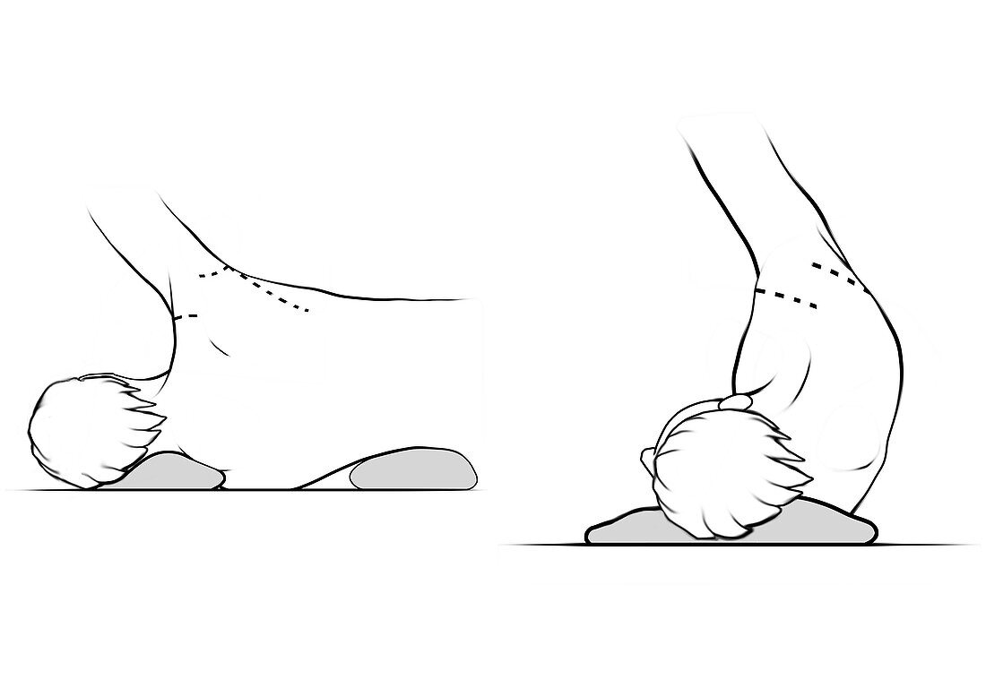 Shoulder posture examination, illustration