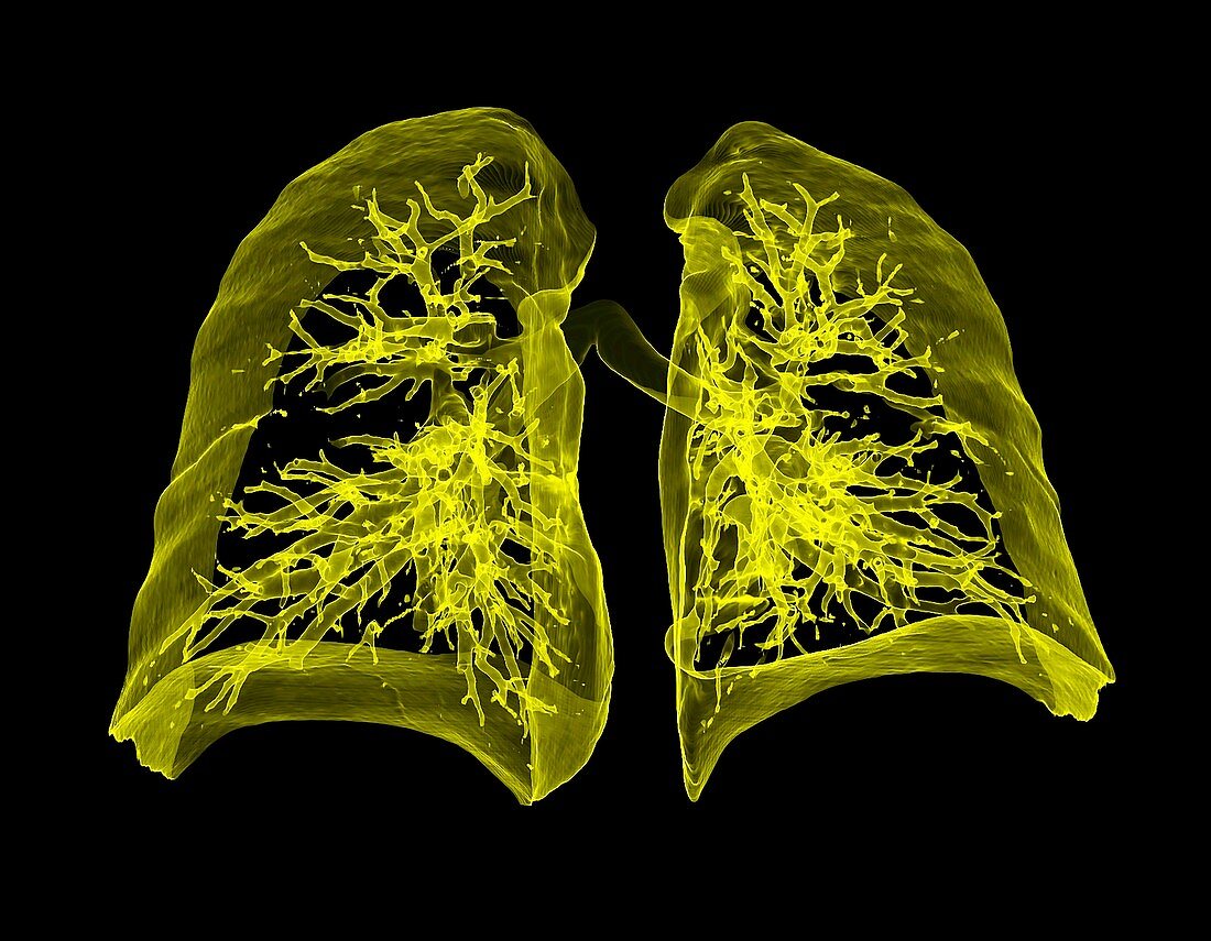 Human lungs, 3D CT scan