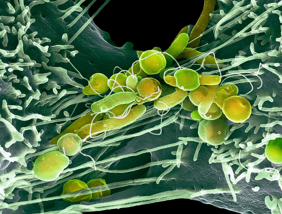 Helicobacter pylori bacteria, SEM