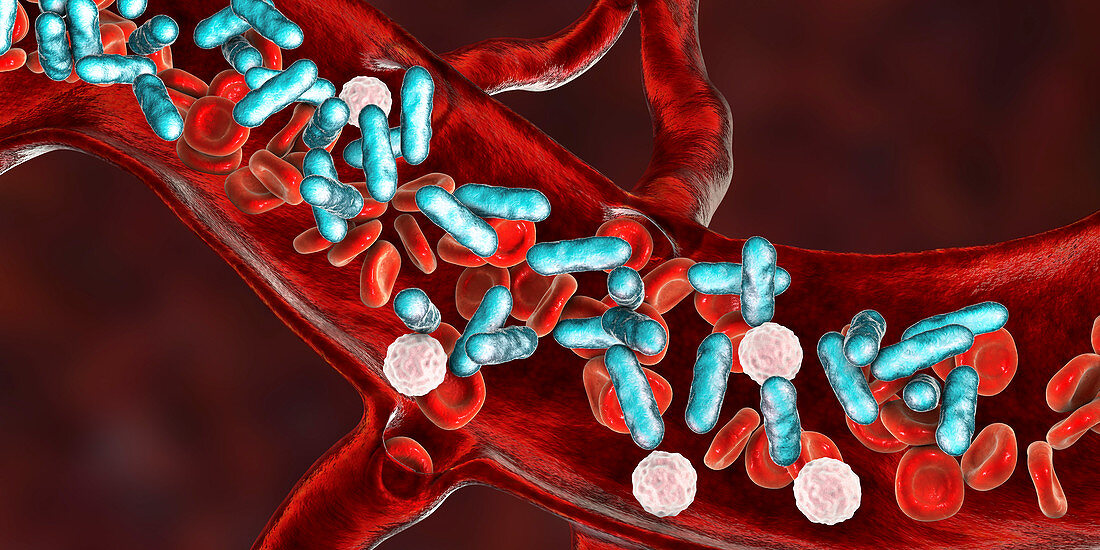 Bacterial blood infection, illustration