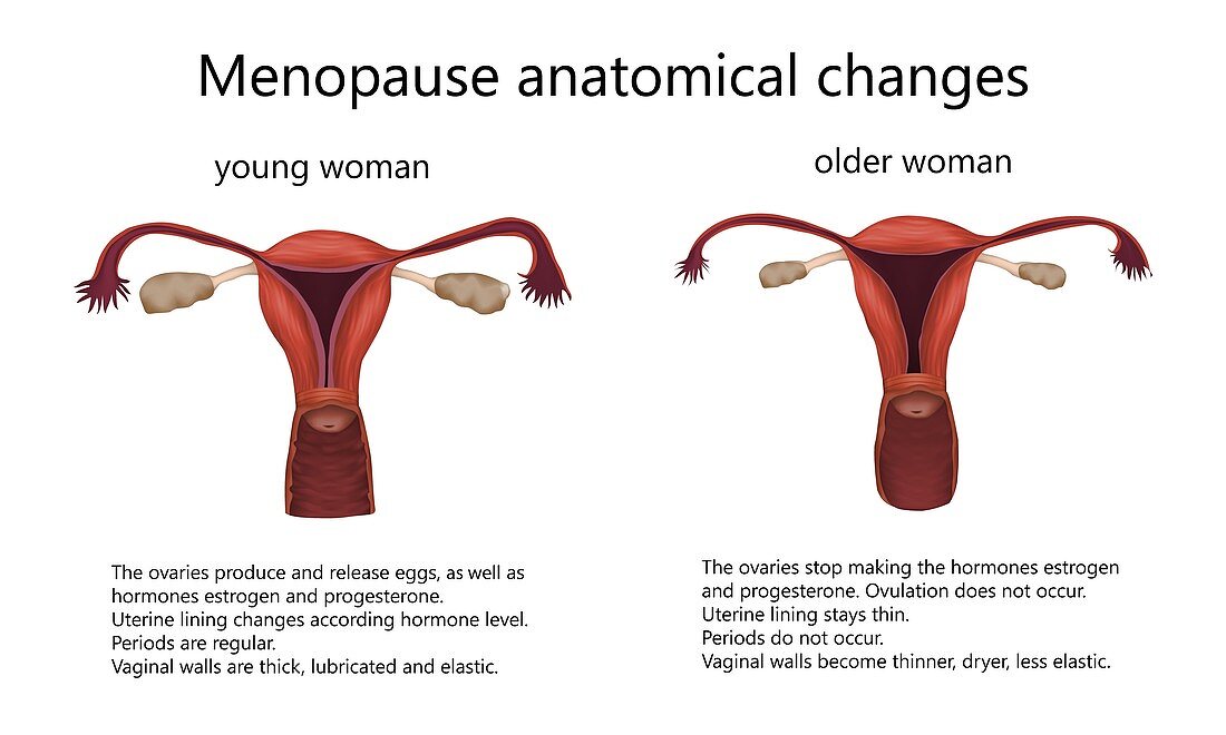 Menopause anatomical changes, illustration