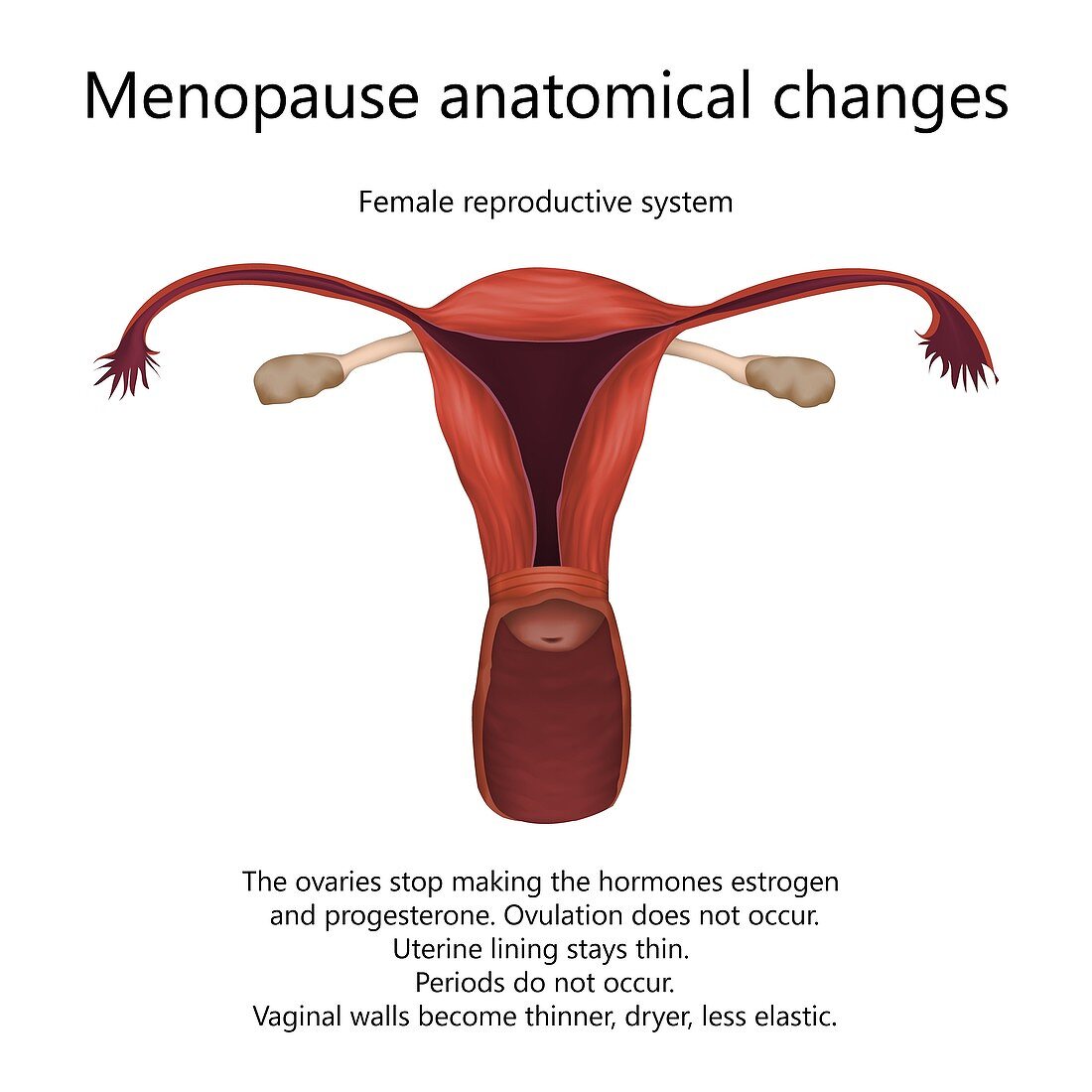 Menopause anatomical changes, illustration
