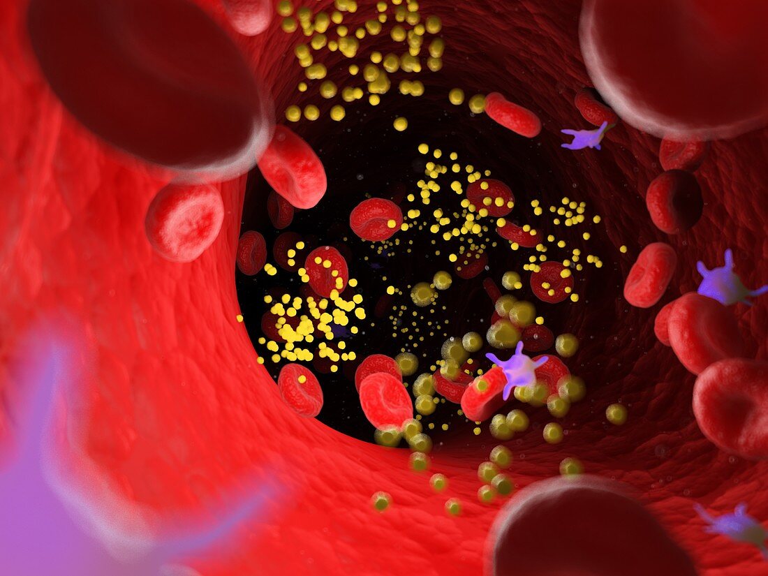 Fat in blood vessels, illustration