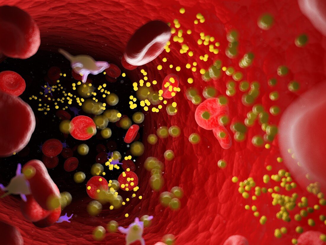 Fat in blood vessels, illustration