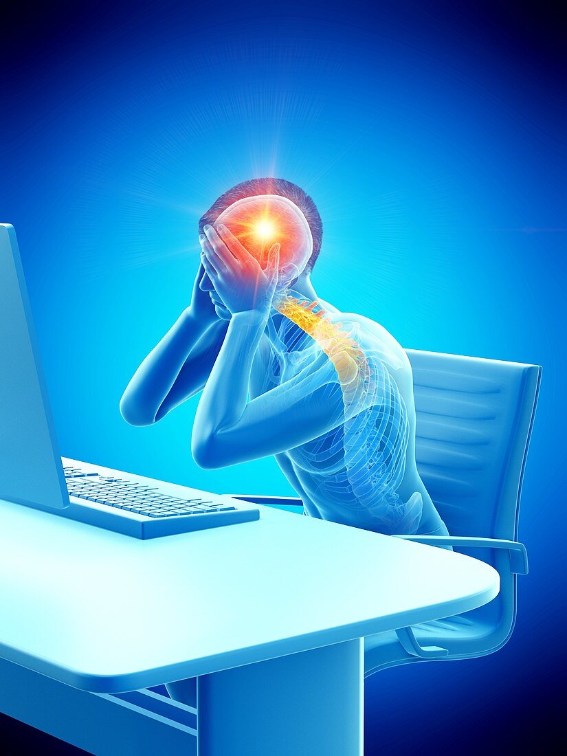 Office worker with headache, conceptual illustration