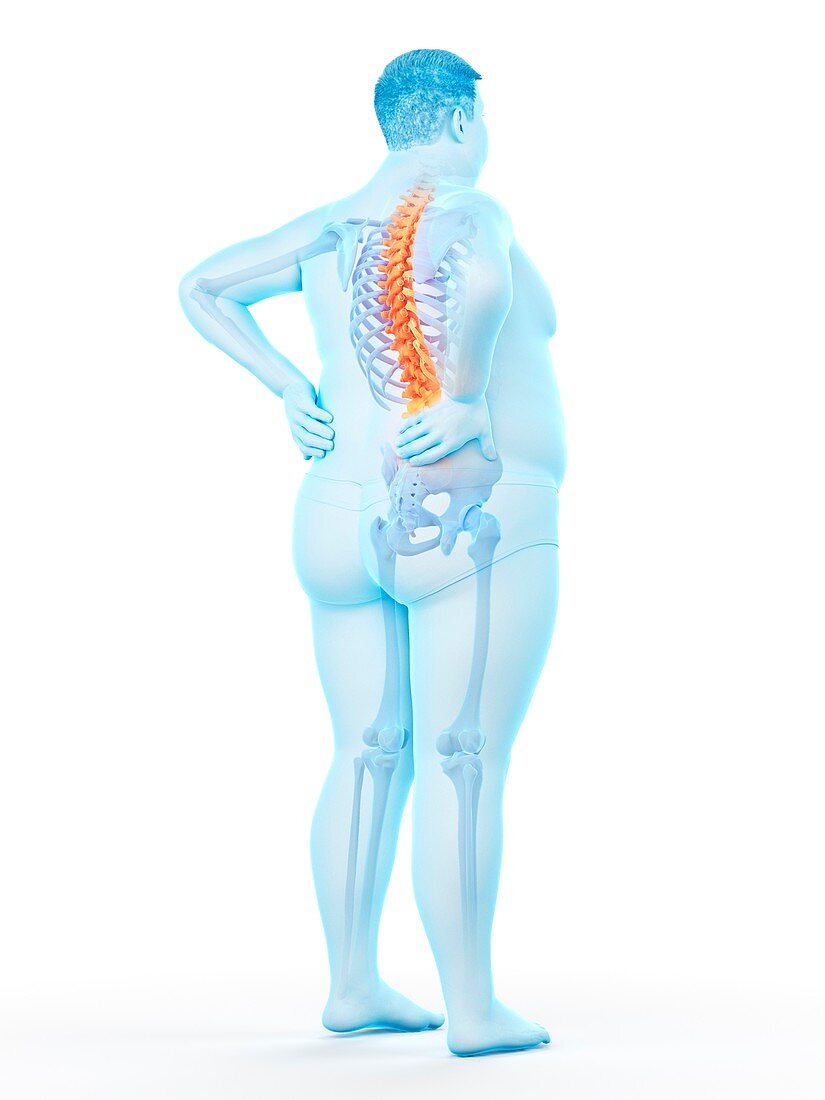 Obese man with back pain, illustration