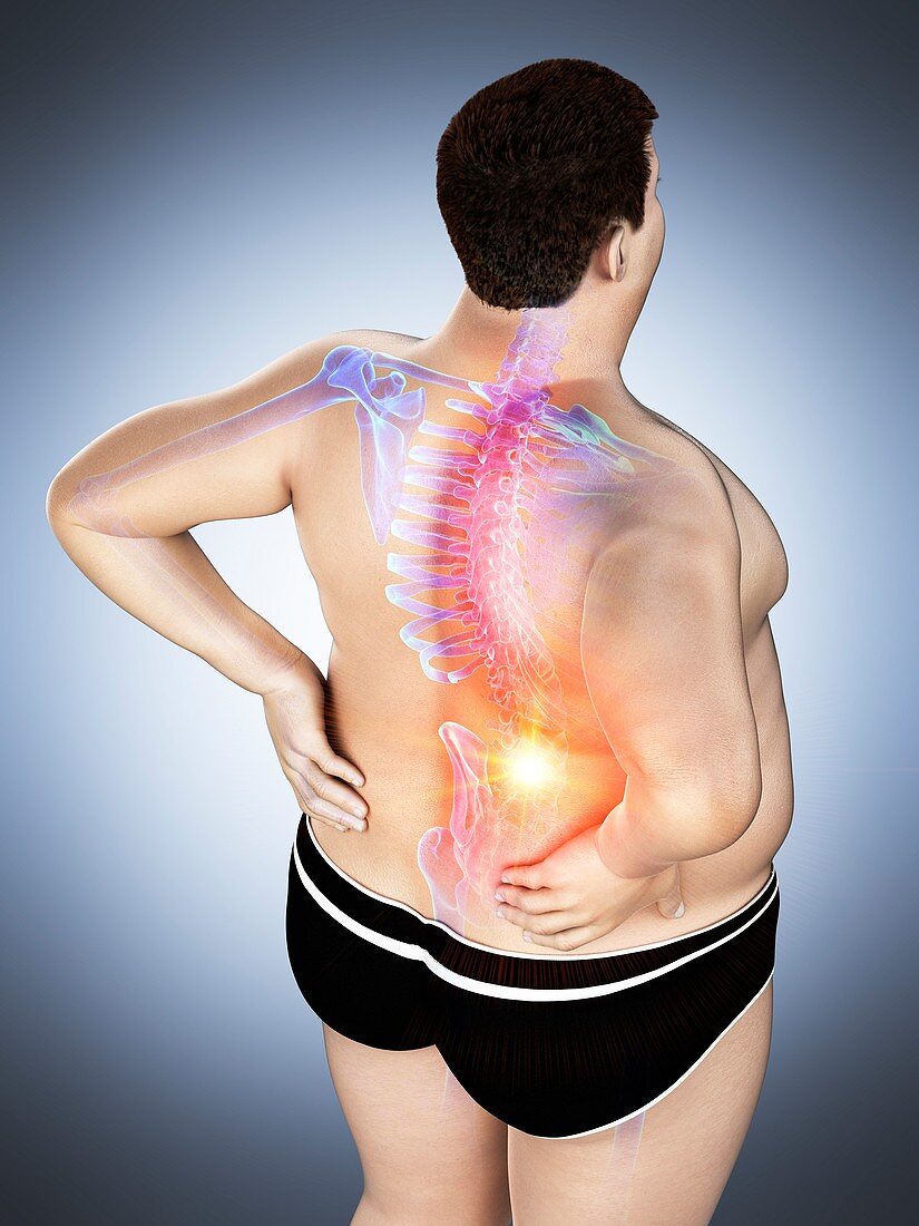 Obese man with back pain, illustration