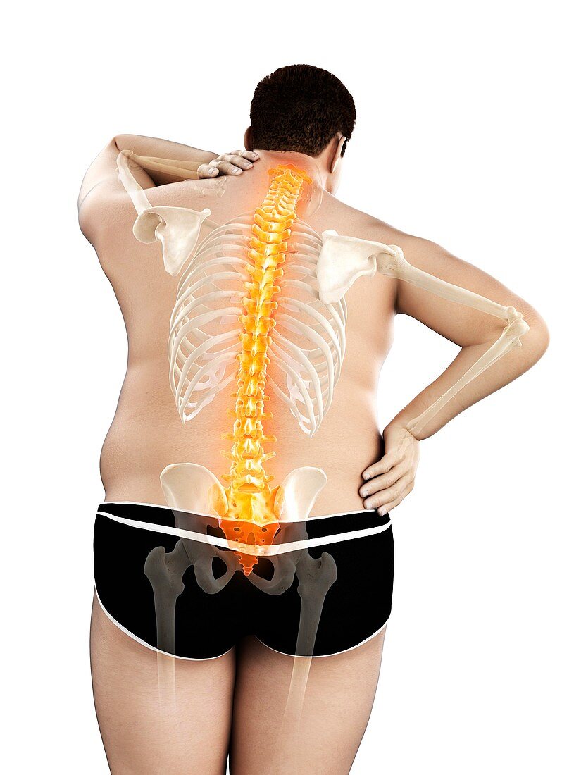 Obese man with back pain, illustration