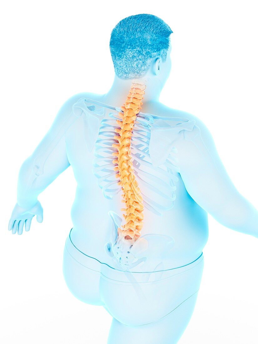 Obese man with back pain, illustration