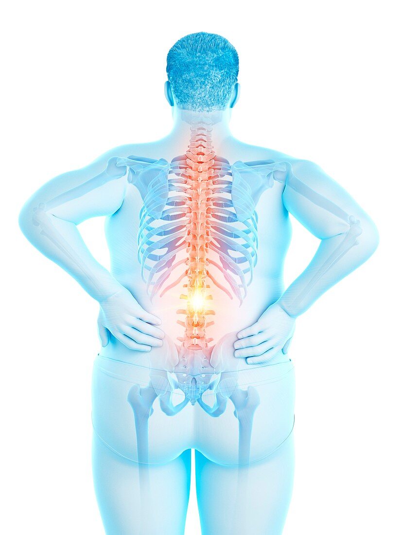 Obese man with back pain, illustration