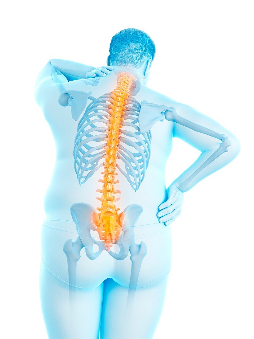 Obese man with back pain, illustration