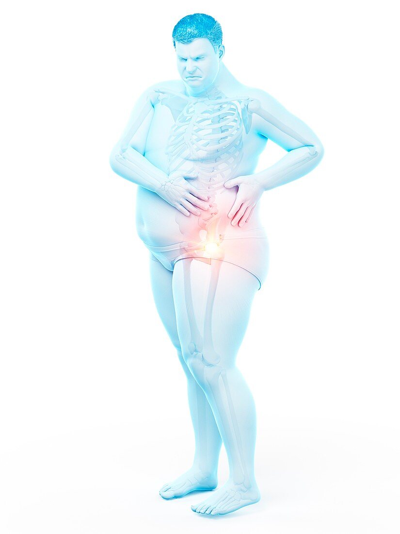 Obese man with hip pain, illustration