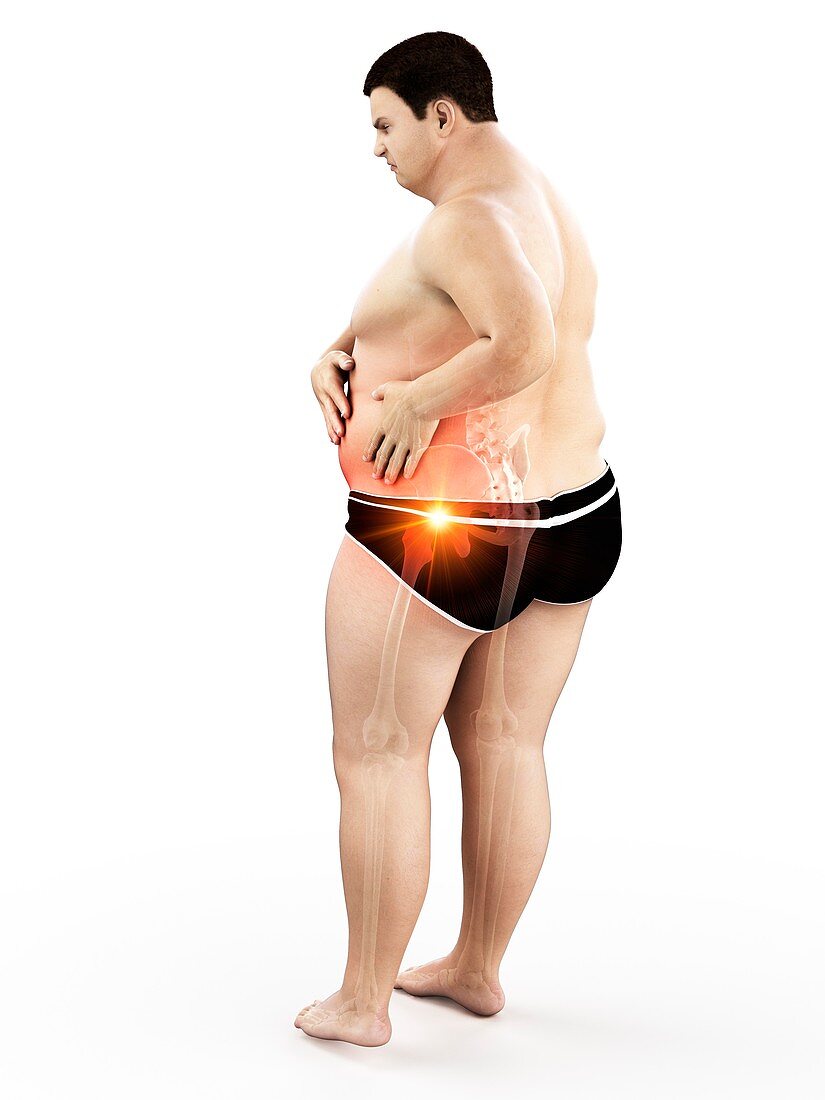 Obese man with hip pain, illustration