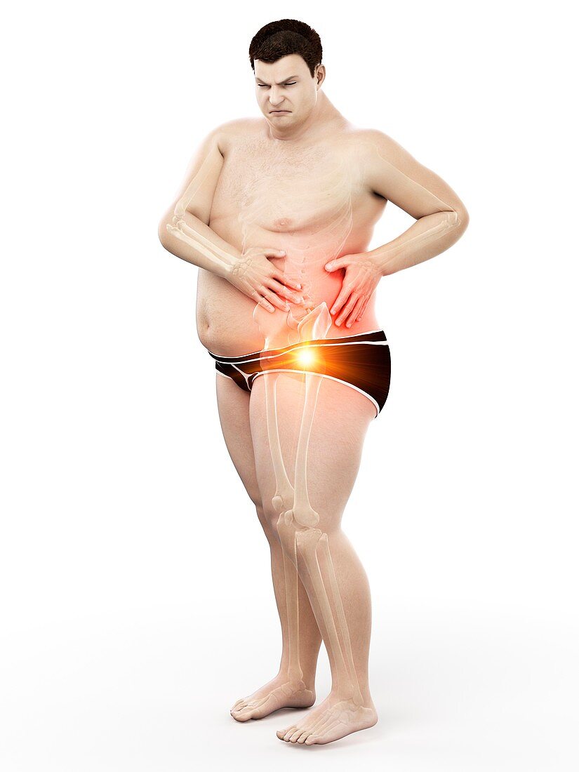 Obese man with hip pain, illustration