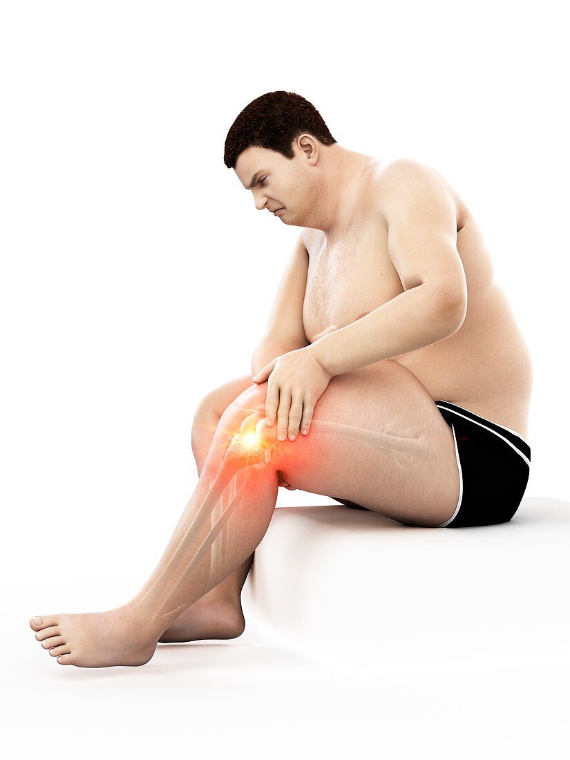 Obese man with knee pain, illustration