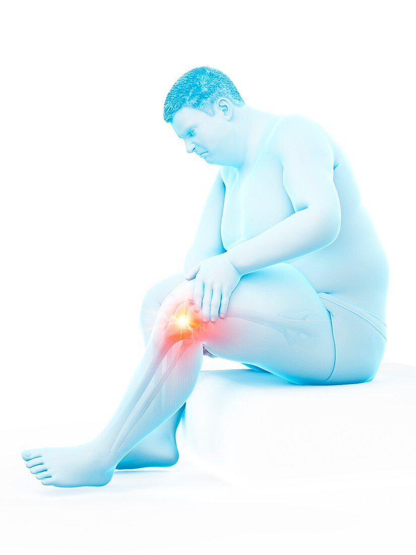 Obese man with knee pain, illustration