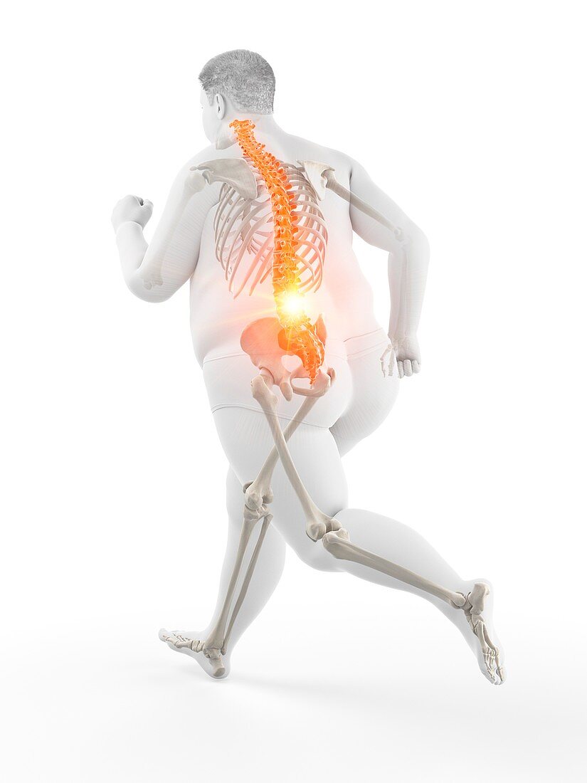 Obese runner with back pain, illustration