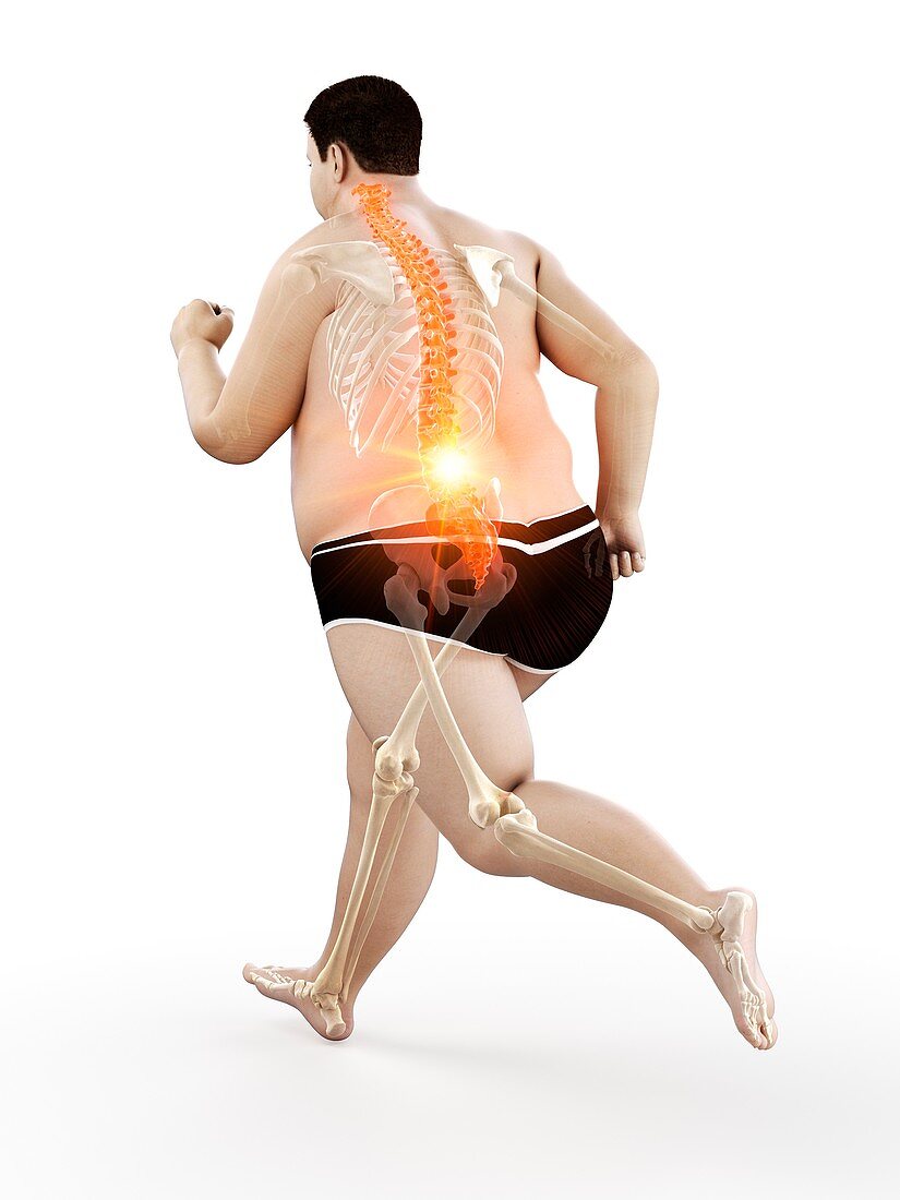 Obese runner with back pain, illustration