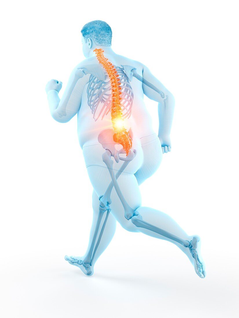 Obese runner with back pain, illustration