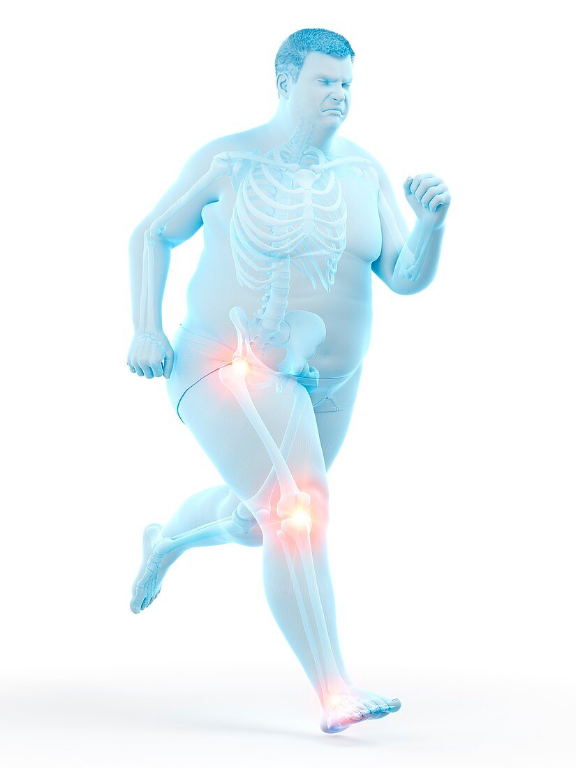 Obese runner with joint pain, illustration