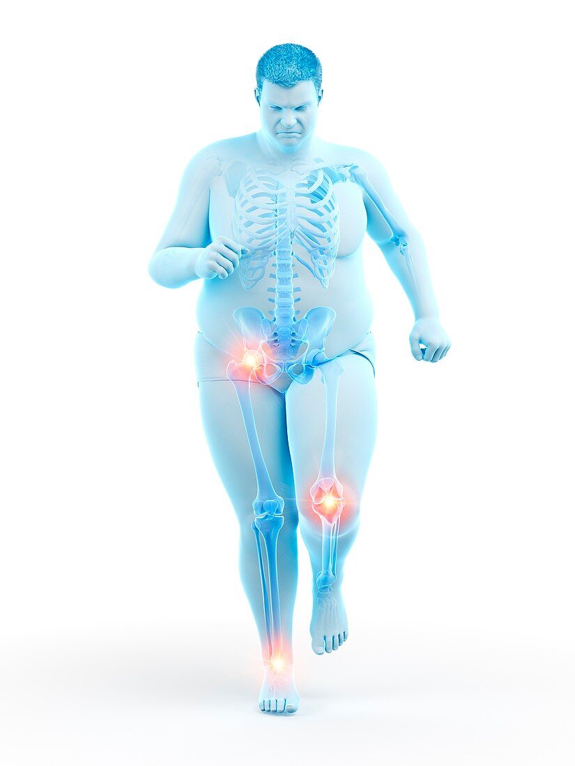 Obese runner with joint pain, illustration