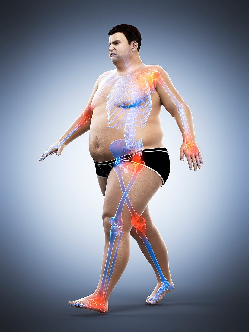 Obese runner with joint pain, illustration