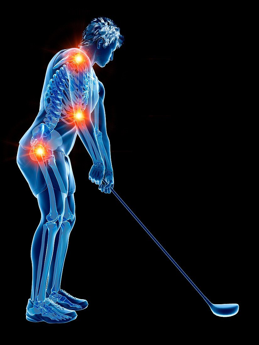 Golf player with painful joints, illustration