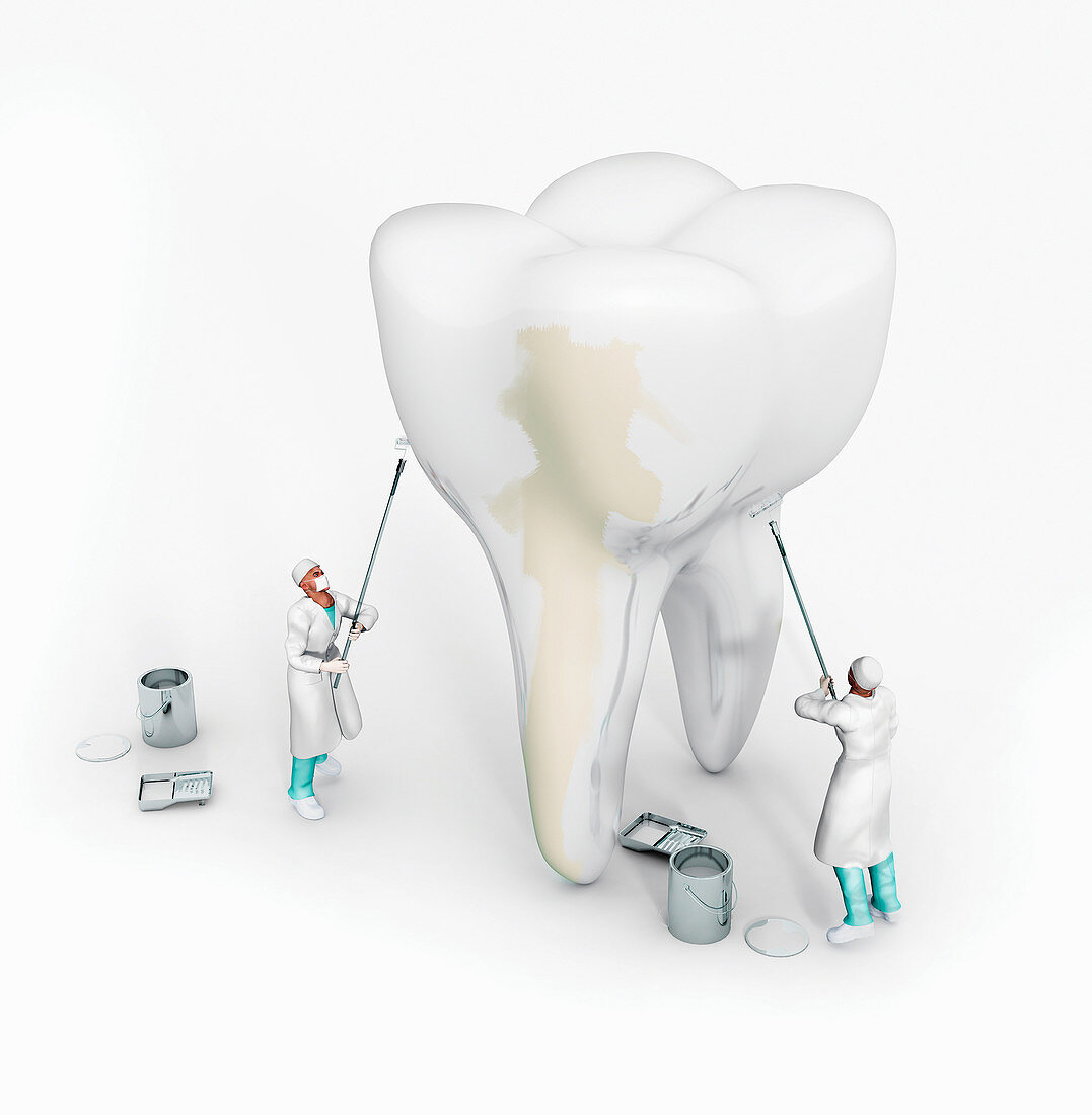 Dentists whitening large tooth, illustration