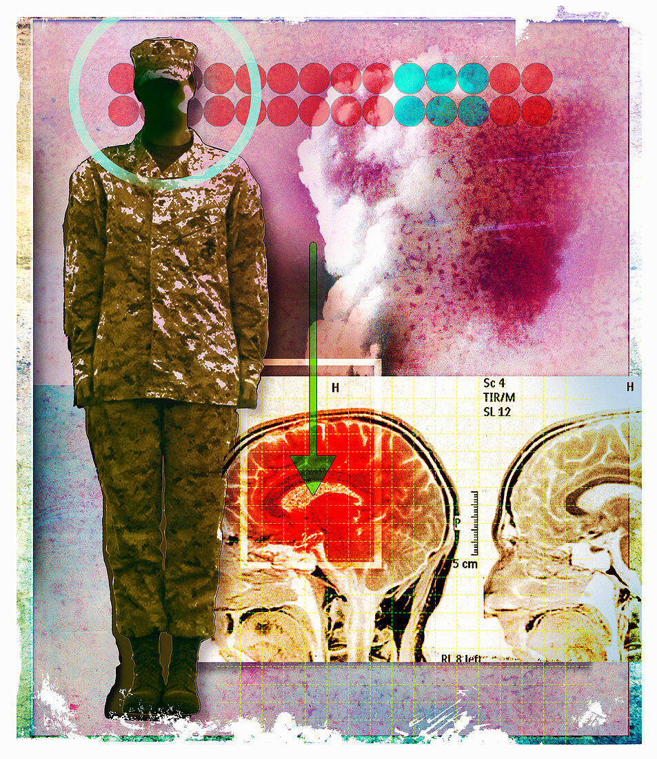 Image of inflamed brain next to soldier, illustration