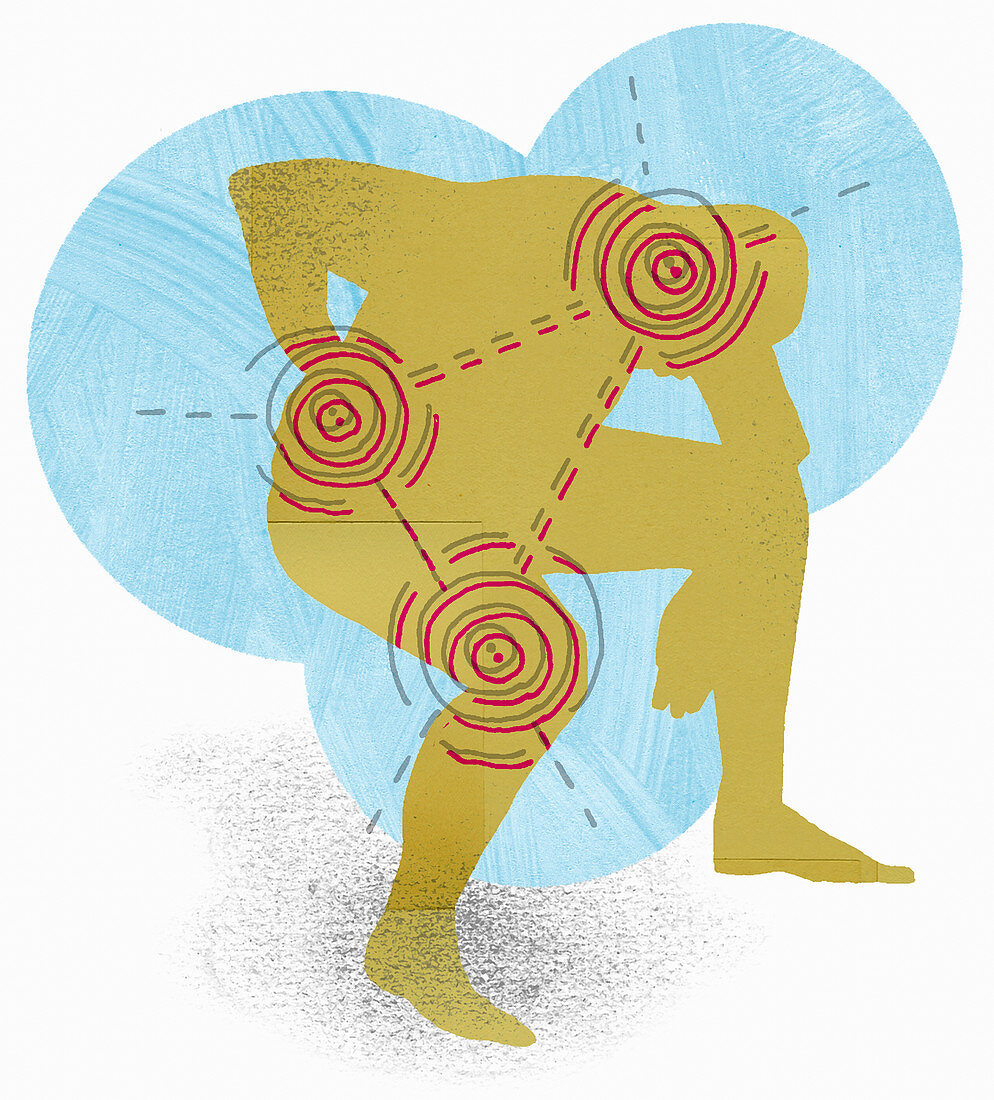Targets over man with joint pain, illustration