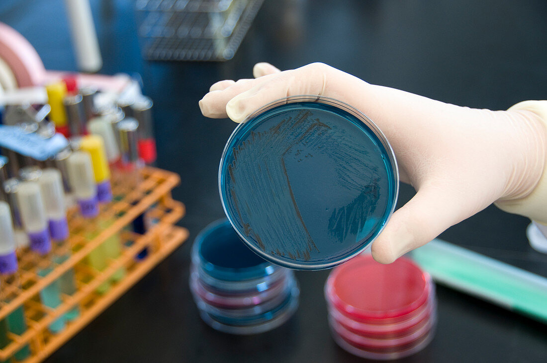 Laboratory microbial food tests