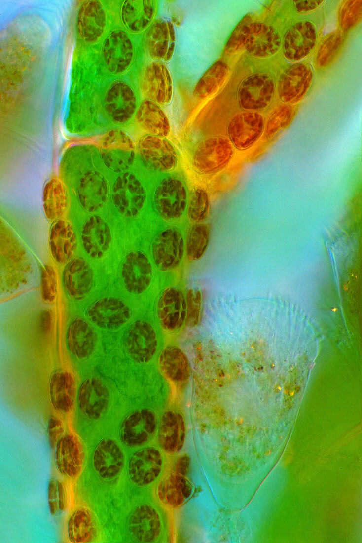 Diatoms on cladophora algae, light micrograph