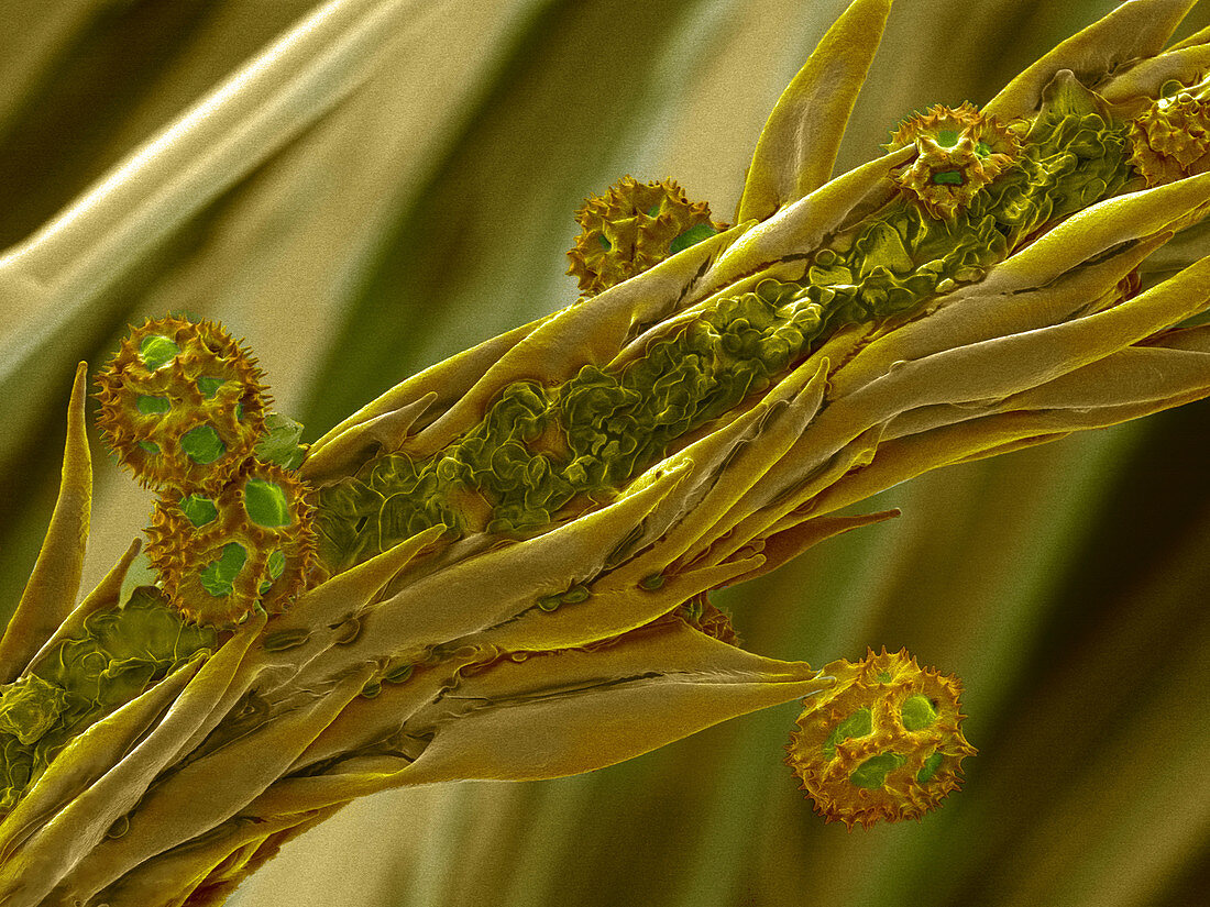 Dandelion pollen and stigma, SEM