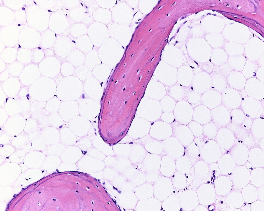 Cancellous bone trabeculae, light micrograph