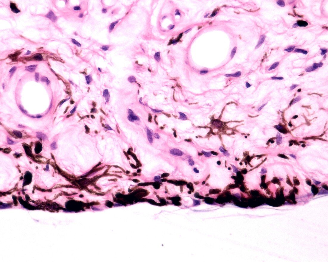 Anterior surface of iris, light micrograph
