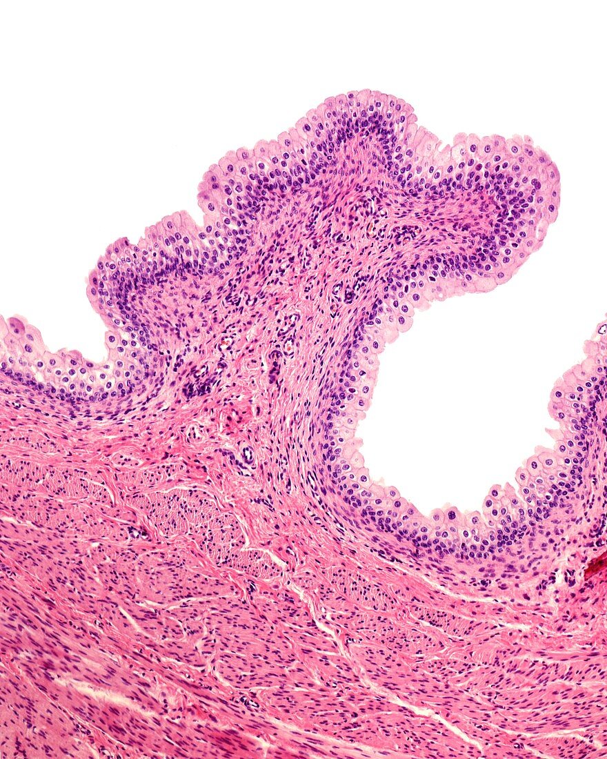 Urinary bladder mucosa, light micrograph