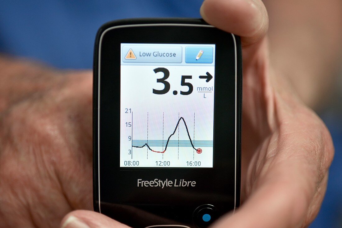 Blood sugar level testing in diabetes