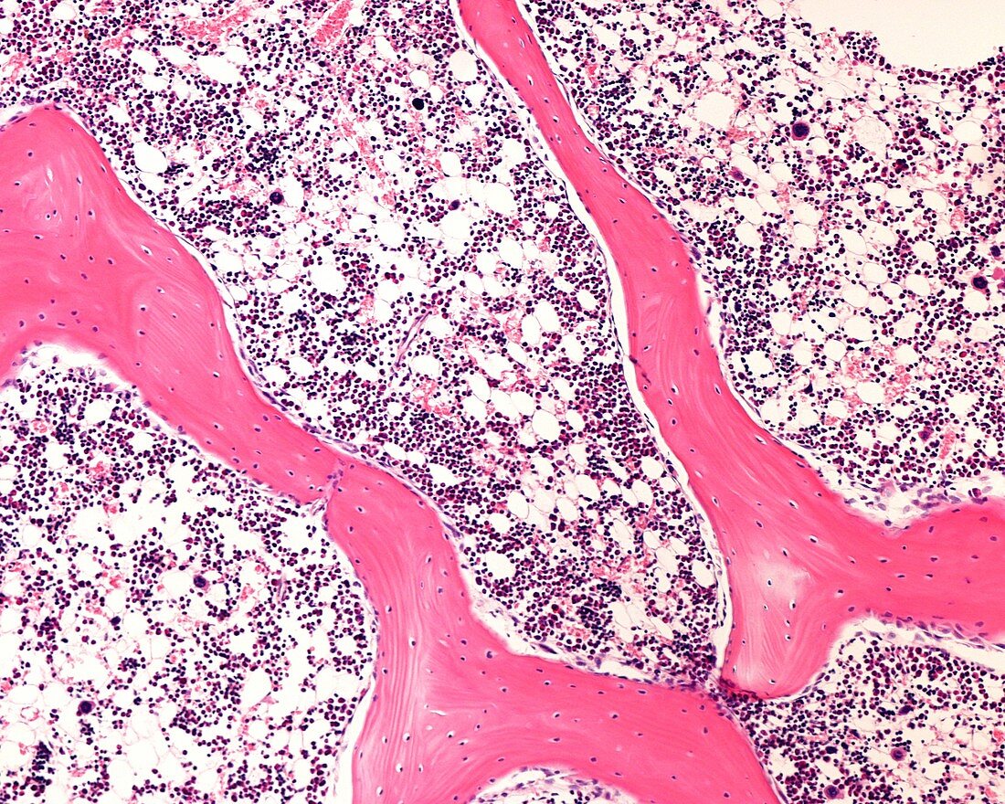 Bone marrow, light micrograph