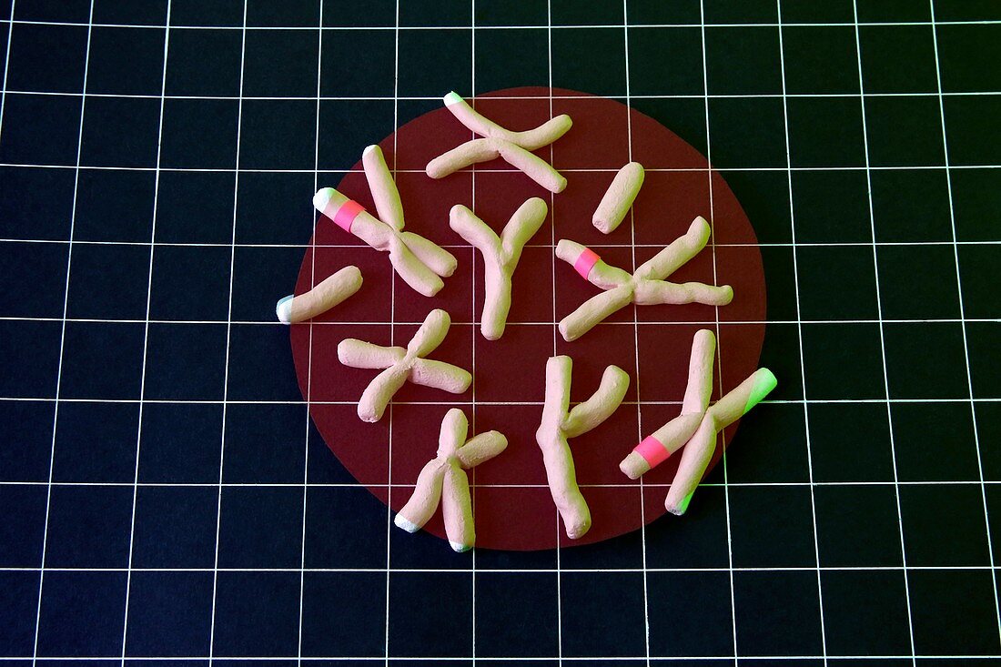 Chromosomal abnormalities, conceptual image