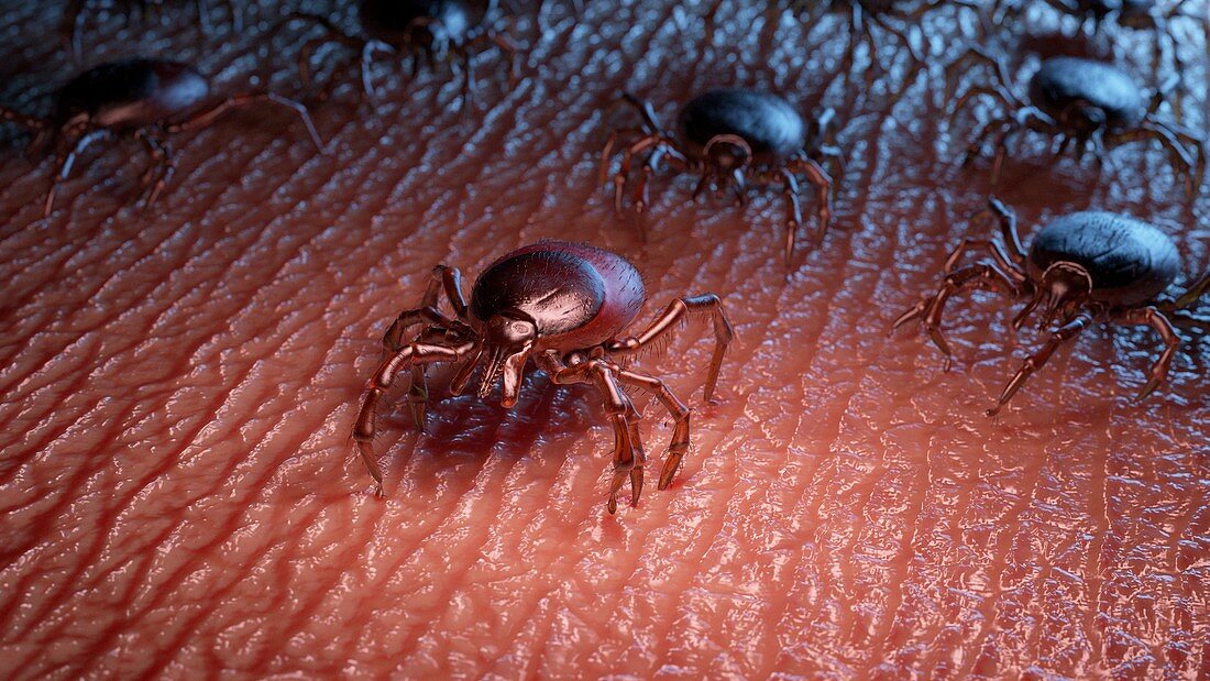 Ticks on human skin, illustration