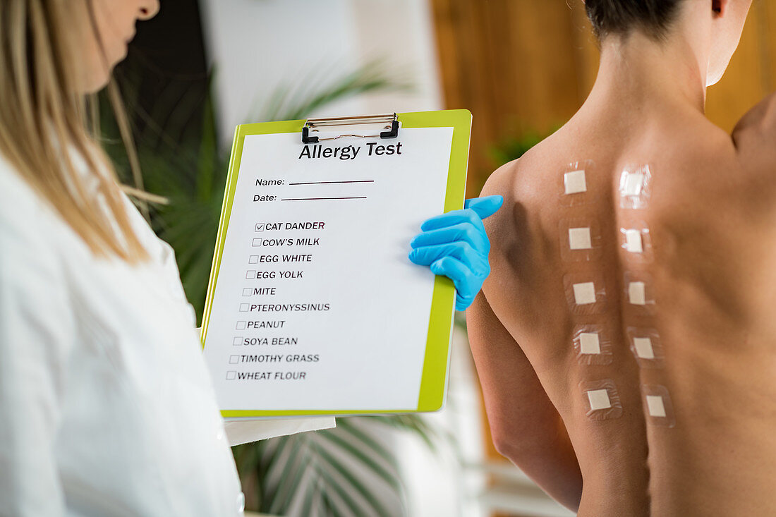 Doctor doing skin allergy test