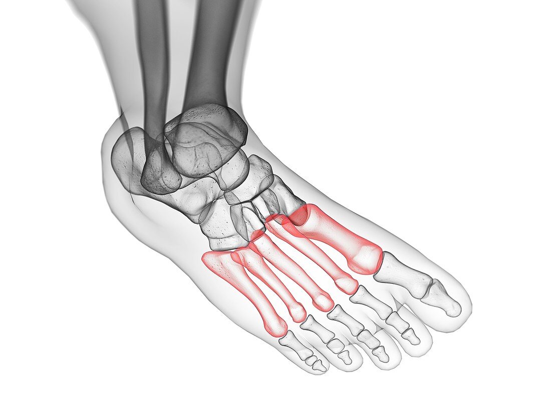 Metatarsal bones, illustration