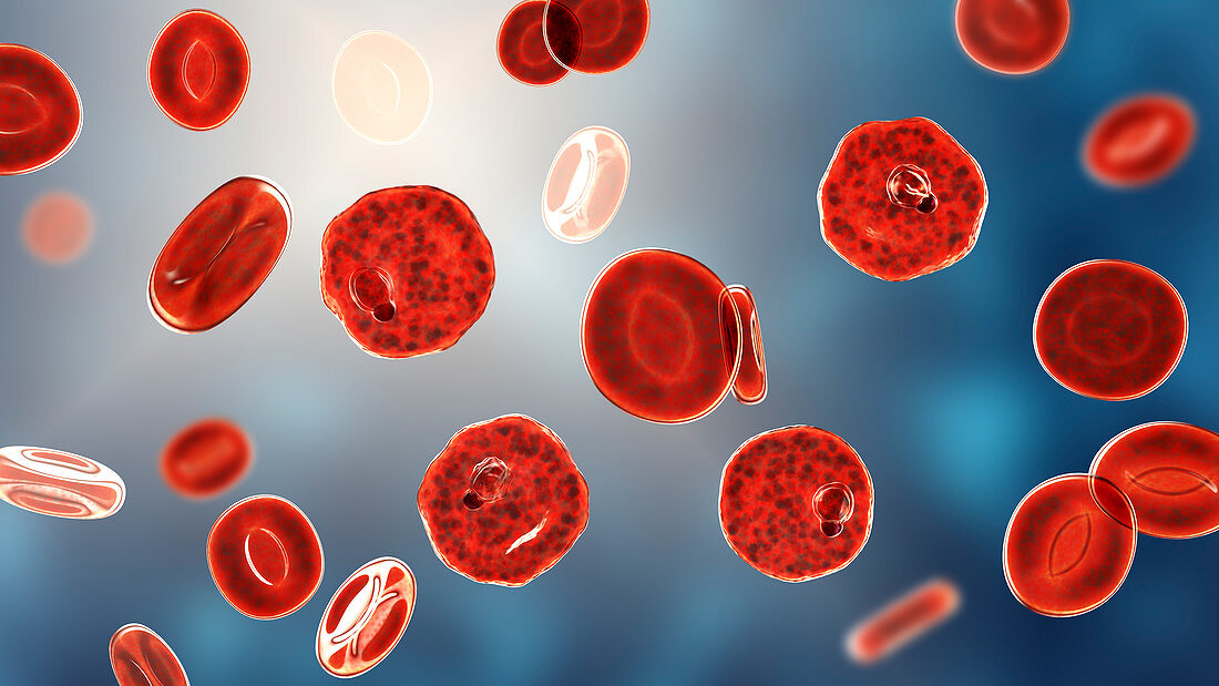 Plasmodium vivax inside red blood cells, illustration